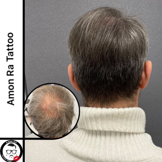 Tricopigmentazione effetto densità